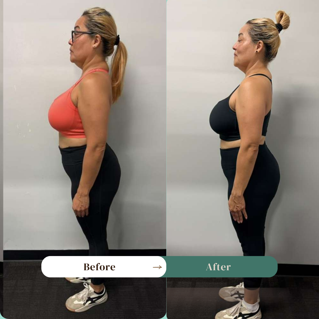 Transformación real de un cliente de AriFlexness: antes y después